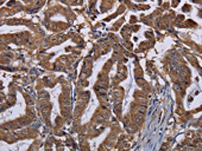 MCTS1 Antibody