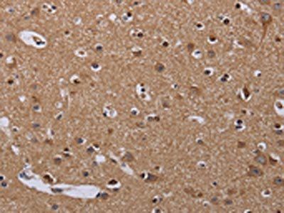 MCTS1 Antibody