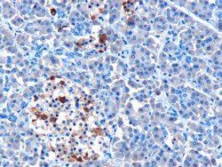 Goat anti-MDA5 / IFIH1 Antibody