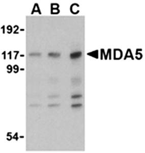 MDA5 Antibody