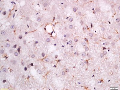 MDGA2 Rabbit Polyclonal Antibody