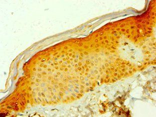 MDH1 Antibody