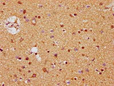 MDH1 Antibody