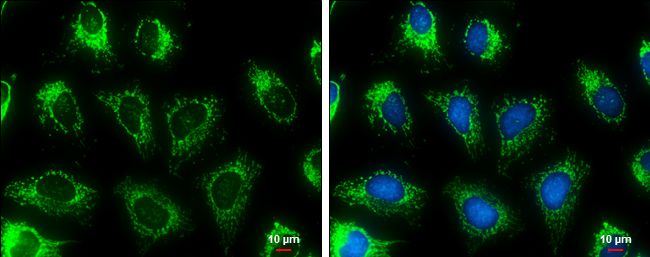 malate dehydrogenase 2 Antibody