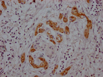 MDK Recombinant Monoclonal Antibody