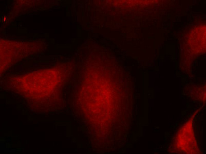 MDM2 (Ab-166) antibody