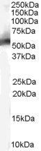 MDM2 antibody