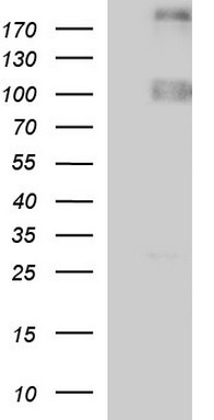 MDMX (MDM4) antibody