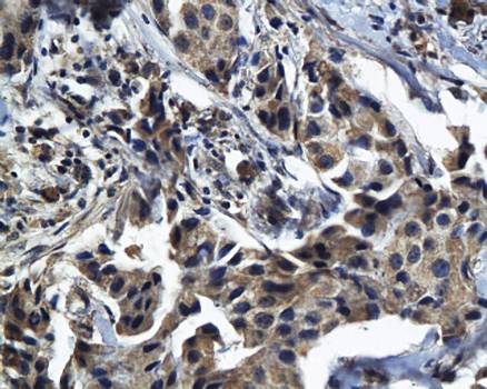 MDR1 Rabbit Polyclonal Antibody
