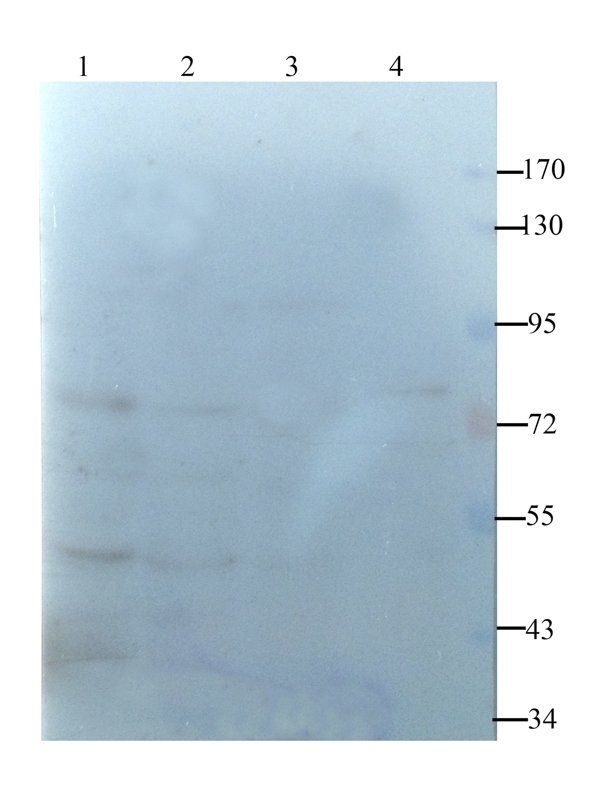 MDR1 antibody