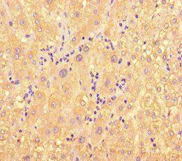 ME1 Antibody