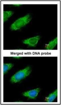 malic enzyme 1 Antibody