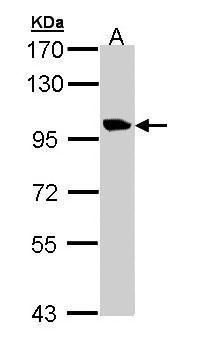 meckelin isoform 1 antibody