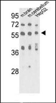 MeCP2 antibody