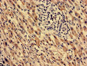 MECR Antibody
