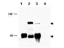 MECT1 antibody
