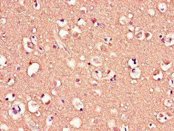 MED12 Antibody