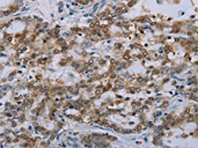 MED12 Antibody
