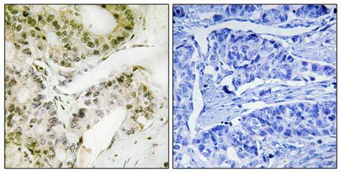 MED13 Antibody