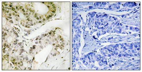 MED13 antibody