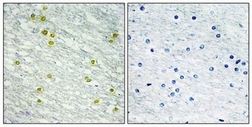 MED14 Antibody