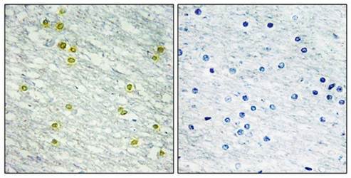 MED14 antibody