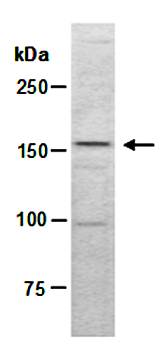 MED14 (C) Antiboday, Rabbit Polyclonal