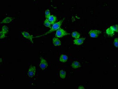 MED15 antibody