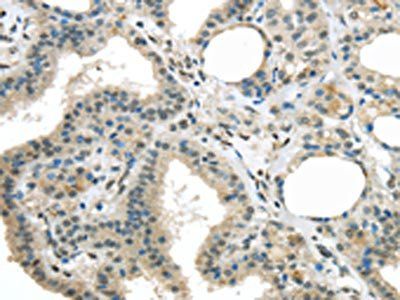 MED15 Antibody