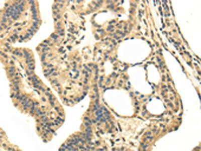MED16 Antibody