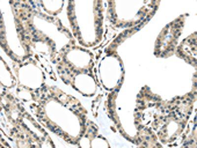 MED18 Antibody