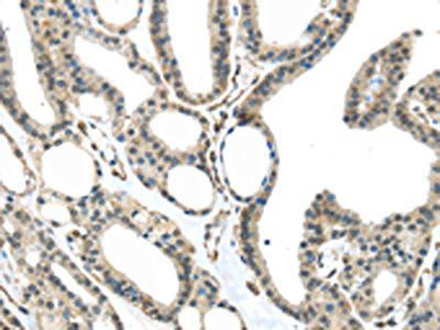 MED18 antibody