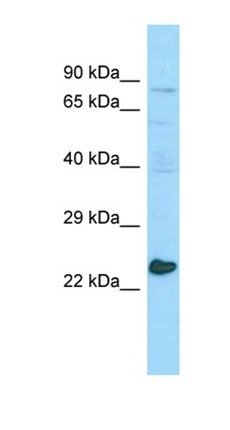 MED20 antibody
