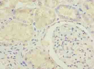 MED22 antibody