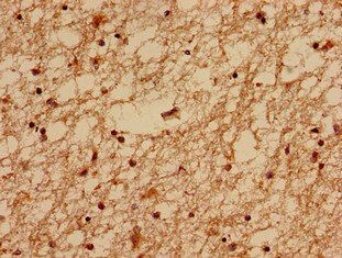 MED24 Antibody