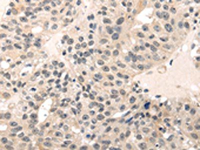 MED28 Antibody