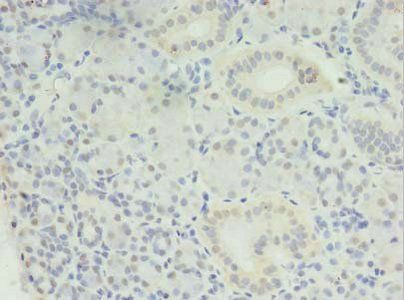 MED30 antibody