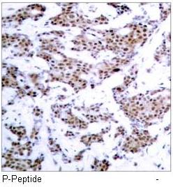 MEF2A (Phospho-Thr312) Antibody