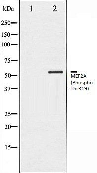 MEF2A (Phospho-Thr319) antibody