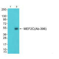 MEF2C (Ab-396) antibody