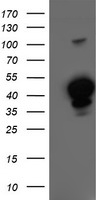 MEF2C Antibody