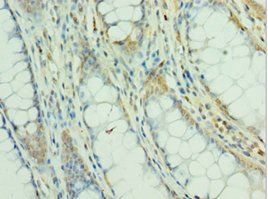 MEF2C Antibody