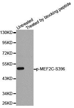 MEF2C (phospho-S396) antibody