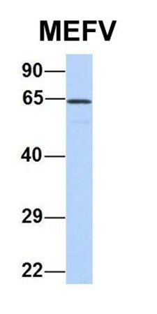 MEFV antibody