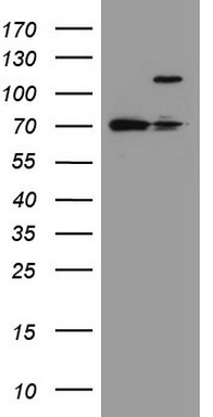 Meis homeobox 3 Antibody