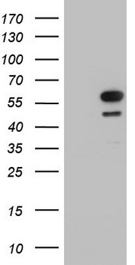 Meis homeobox 3 (MEIS3) antibody