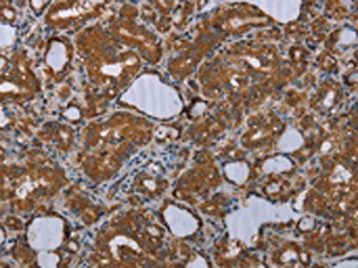 MEIS1 Antibody
