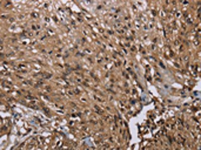 MEIS1 Antibody