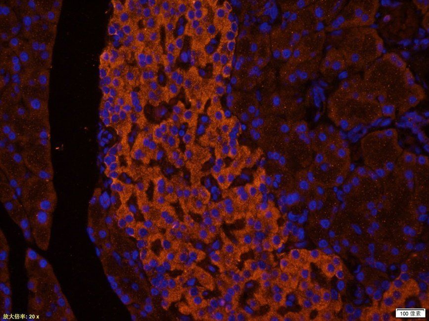 MEIS1 Rabbit Polyclonal Antibody