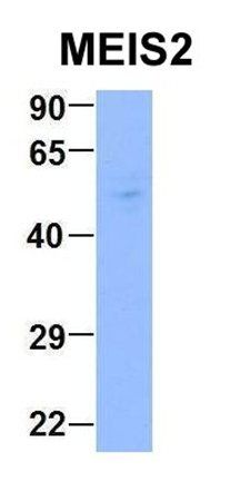 MEIS2 antibody